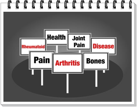 Arthritis Signs